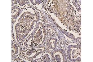 IHC analysis of IRS1 using anti-IRS1 antibody (ABIN7599659). (IRS1 anticorps  (AA 1041-1242))