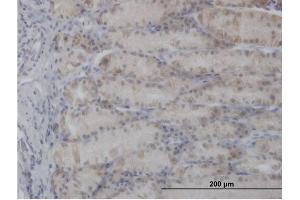 Immunoperoxidase of purified MaxPab antibody to PDHA1 on formalin-fixed paraffin-embedded human stomach.
