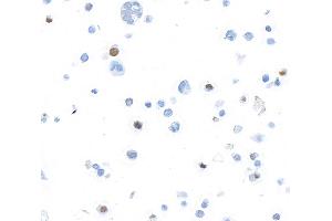 Immunocytochemistry (ICC) image for anti-Forkhead Box P3 (FOXP3) (AA 275-325) antibody (ABIN7455209)