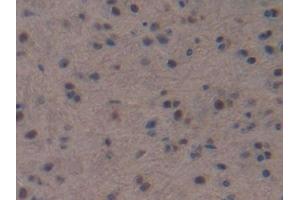 IHC-P analysis of Mouse Brain Tissue, with DAB staining. (NPPC anticorps  (AA 30-126))