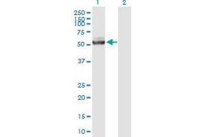 Western Blot analysis of IQCB1 expression in transfected 293T cell line by IQCB1 MaxPab polyclonal antibody. (IQCB1 anticorps  (AA 1-465))