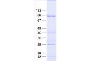 Validation with Western Blot
