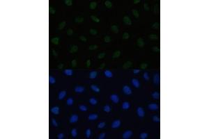 Immunofluorescence analysis of U2OS cells using HSF1 antibody (ABIN6131141, ABIN6142021, ABIN6142022 and ABIN6217875) at dilution of 1:100.