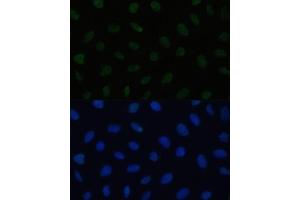 Immunofluorescence analysis of U2OS cells using HSF1 antibody (ABIN6131141, ABIN6142021, ABIN6142022 and ABIN6217875) at dilution of 1:100. (HSF1 anticorps  (AA 350-529))