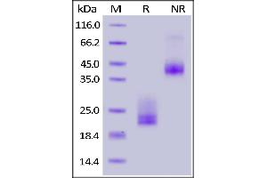 Biotinylated Human CD3E&CD3D Heterodimer Protein, His,Avitag&Tag Free on  under reducing (R) and ing (NR) conditions.