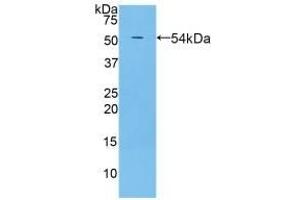 Detection of Recombinant PZP, Rat using Polyclonal Antibody to Pregnancy Zone Protein (PZP) (PZP anticorps  (AA 1251-1500))
