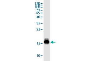 Image no. 2 for Tumor Necrosis Factor Receptor Superfamily, Member 9 (TNFRSF9) (AA 46-128) protein (His-DYKDDDDK-Strep II Tag) (ABIN5570036)