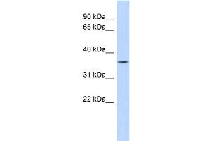 WB Suggested Anti-MMP23B Antibody Titration:  0. (MMP23B anticorps  (Middle Region))
