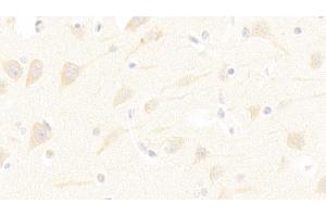 Detection of EAAT3 in Human Cerebrum Tissue using Polyclonal Antibody to Excitatory Amino Acid Transporter 3 (EAAT3)