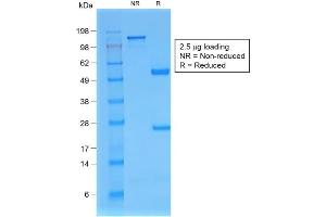 SDS-PAGE Analysis of Purified B2M Mouse Recombinant Monoclonal Antibody ABIN6383845. (Recombinant beta-2 Microglobulin anticorps)