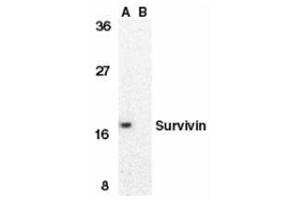 Western blot analysis of survivin in MOLT4 cell lysate in the absence (A) or presence (B) of blocking peptide with this product at 1 μg/ml. (Survivin anticorps  (C-Term))