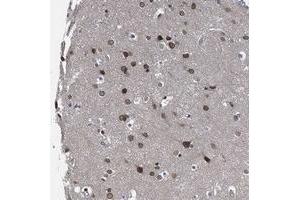 Immunohistochemical staining of human cerebral cortex with CCDC34 polyclonal antibody  shows moderate nuclear membrane positivity in neuronal cells at 1:500-1:1000 dilution. (CCDC34 anticorps)