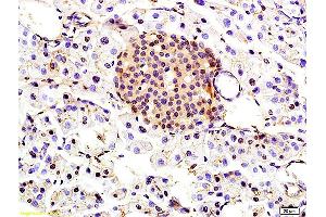 Formalin-fixed and paraffin embedded rat kidney labeled with Anti-TBRG1 Polyclonal Antibody, Unconjugated (ABIN706151) at 1:200 followed by conjugation to the secondary antibody and DAB staining (TBRG1 anticorps  (AA 28-130))