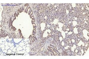 Immunohistochemical analysis of paraffin-embedded rat lung tissue. (PDGFB anticorps  (AA 30-110))