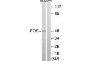 Western blot analysis of extracts from RAW264. (c-FOS anticorps  (AA 201-250))