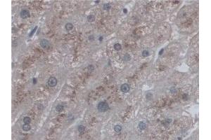 Detection of CD209 in Human Liver Tissue using Polyclonal Antibody to Cluster Of Differentiation 209 (CD209) (DC-SIGN/CD209 anticorps  (AA 70-404))