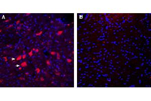 Expression of CD157 in rat deep cerebellar nuclei. (BST1 anticorps  (Extracellular))