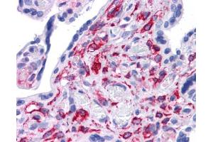 Immunohistochemistry (IHC) image for anti-Signal Transducer and Activator of Transcription 5B (STAT5B) (C-Term) antibody (ABIN2779972) (STAT5B anticorps  (C-Term))