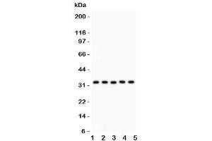 Western blot testing of HO-1 antibody and Lane 1:  human placenta
