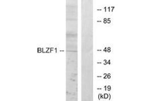 Western blot analysis of extracts from Jurkat cells, using BLZF1 Antibody. (BLZF1 anticorps  (AA 10-59))