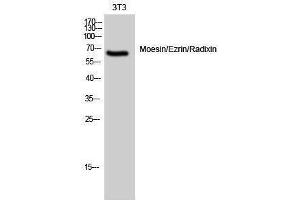 Western Blotting (WB) image for anti-Moesin/ezrin/radixin (Ser105) antibody (ABIN3185614) (Moesin/ezrin/radixin (Ser105) anticorps)