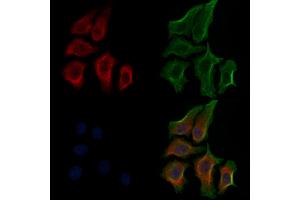 ABIN6256204 and ABIN6267563 staining HepG2 cells(30 min of 4uM Forskolin treatment) by IF/ICC. (RPS6 anticorps  (pSer235))