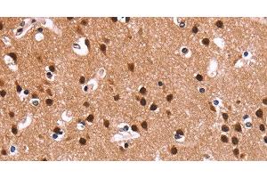 Immunohistochemistry of paraffin-embedded Human brain using RPSA Polyclonal Antibody at dilution of 1:60 (RPSA/Laminin Receptor anticorps)