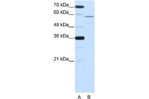 WB Suggested Anti-NOVA2 Antibody Titration:  2. (NOVA2 anticorps  (Middle Region))