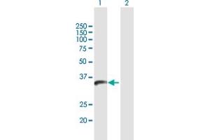 Western Blot analysis of PPIL6 expression in transfected 293T cell line by PPIL6 MaxPab polyclonal antibody. (PPIL6 anticorps  (AA 1-311))