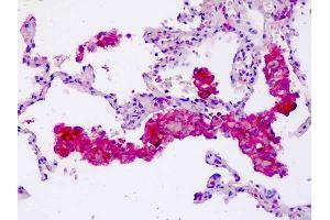 Anti-CORO6 antibody IHC staining of human lung, macrophages.