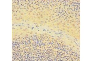 Immunohistochemistry of paraffin-embedded human tonsil tissue using ABIN7150361 at dilution of 1:100 (IKZF1 anticorps  (AA 1-265))