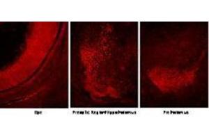 Immunofluorescence microscopy using  Protein A purified anti-Six3 antibody shows detection of Six3 in various E14.