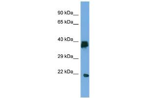 Host:  Rabbit  Target Name:  LIPT2  Sample Type:  Placenta lysates  Antibody Dilution:  1. (LIPT2 anticorps  (C-Term))