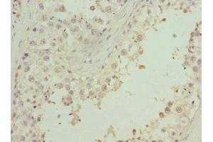 Immunohistochemistry of paraffin-embedded human testis tissue using ABIN7176258 at dilution of 1:100