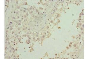 Immunohistochemistry of paraffin-embedded human testis tissue using ABIN7176258 at dilution of 1:100 (ZNF35 anticorps  (AA 233-532))