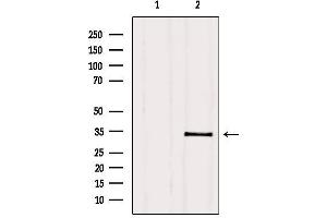 Western blot analysis of extracts from HepG2, using PMM2 Antibody.