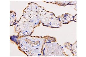 IHC analysis of ADK using anti-ADK antibody (ABIN7600222). (ADK anticorps  (AA 165-351))