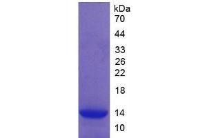 SDS-PAGE of Protein Standard from the Kit (Highly purified E. (Complement Factor B Kit ELISA)