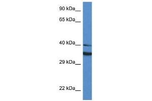 Western Blot showing NQO1 antibody used at a concentration of 1 ug/ml against HT1080 Cell Lysate (NQO1 anticorps  (Middle Region))