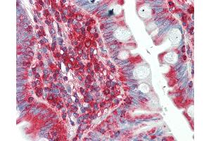 Anti-SCN1B antibody IHC staining of human small intestine. (SCN1B anticorps  (AA 110-159))