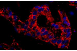 Immunohistochemistry (IHC) image for anti-Sorting Nexin 1 (SNX1) (C-Term) antibody (ABIN7449439) (Sorting Nexin 1 anticorps  (C-Term))