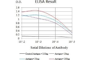Black line: Control Antigen (100 ng),Purple line: Antigen (10 ng), Blue line: Antigen (50 ng), Red line:Antigen (100 ng)