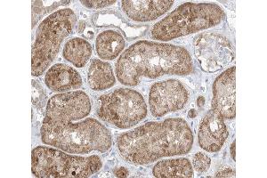 ABIN6266490 at 1/100 staining human kidney tissue sections by IHC-P. (GAB2 anticorps  (C-Term))