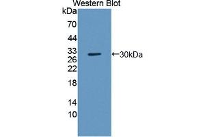 Western blot analysis of the recombinant protein. (TNPO2 anticorps  (AA 17-248))