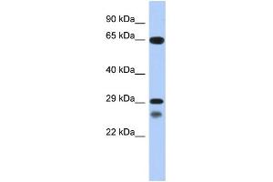 WB Suggested Anti-MYF5 Antibody Titration: 0. (MYF5 anticorps  (C-Term))