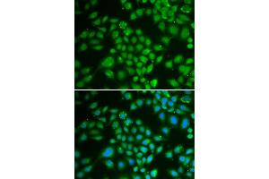Immunofluorescence analysis of HeLa cells using DCK antibody (ABIN3022557, ABIN3022558, ABIN3022559 and ABIN6218902).