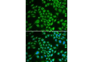 Immunofluorescence analysis of HeLa cells using DCK antibody (ABIN3022557, ABIN3022558, ABIN3022559 and ABIN6218902). (DCK anticorps  (AA 1-260))