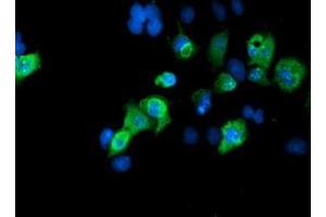 Image no. 3 for anti-SUMO1/sentrin/SMT3 Specific Peptidase 2 (SENP2) (AA 139-523) antibody (ABIN1490927)