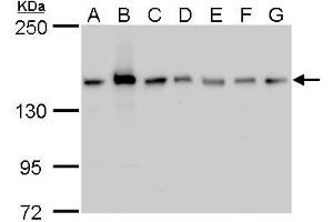 WB Image ROCK2 antibody detects ROCK2 protein by western blot analysis. (ROCK2 anticorps)