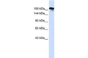 WB Suggested Anti-RSF1 Antibody Titration:  0. (RSF1 anticorps  (Middle Region))